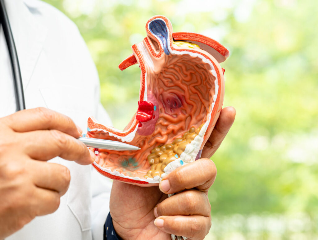 patología digestiva